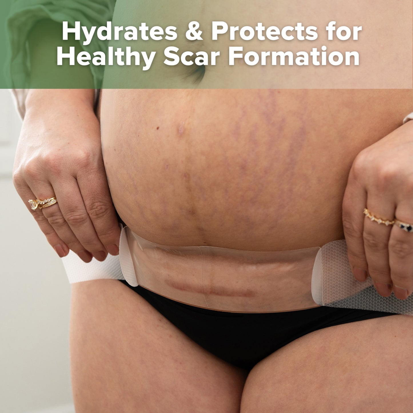 Haakaa Mum C-Section Scar Silicone Patches - 6pc (3 x 0.5mm + 3 x 1mm)